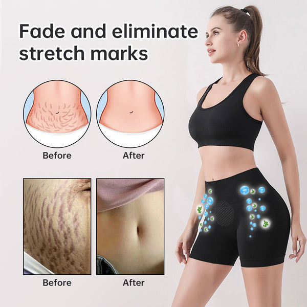 Los Pantalones Cortos Ion Shaping Son Cómodos Y Transpirables Con Tela Turmalina