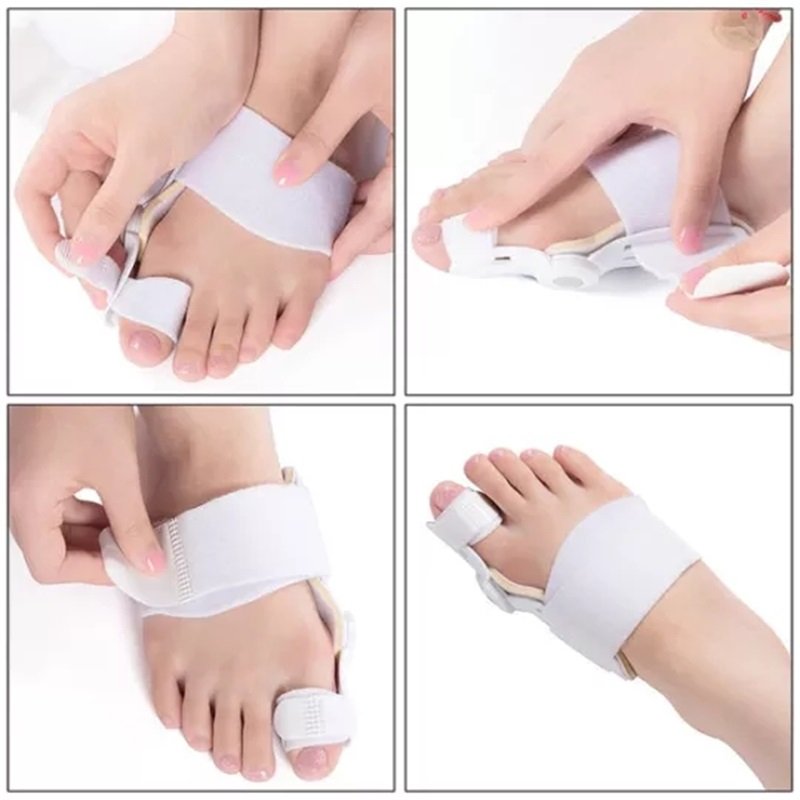 【Recomendado Por El Médico】 Corrector De Juanetes Para Hombres Y Mujeres