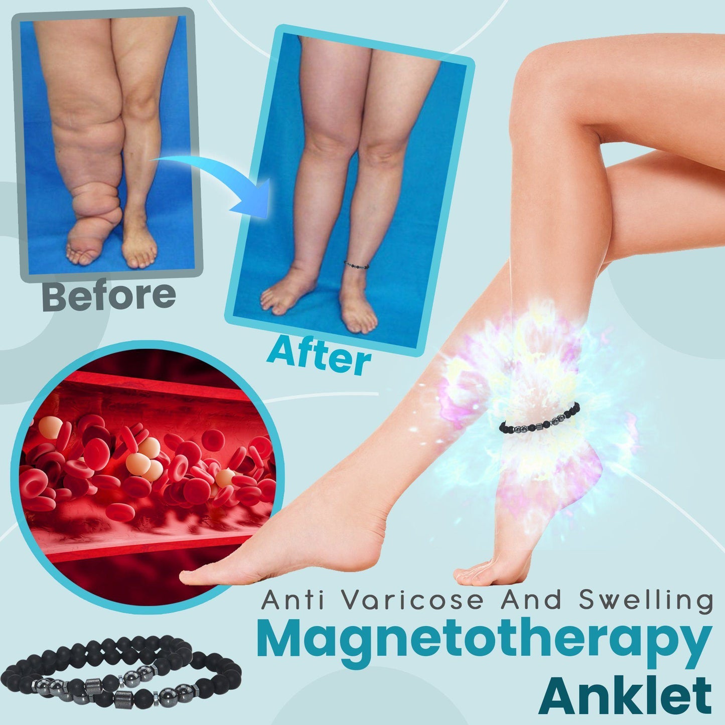 [001] Tobillera De Magnetoterapia Antivaricosa E Inflamatoria