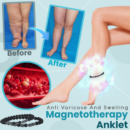 [001] Tobillera De Magnetoterapia Antivaricosa E Inflamatoria